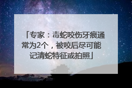 专家：毒蛇咬伤牙痕通常为2个，被咬后尽可能记清蛇特征或拍照