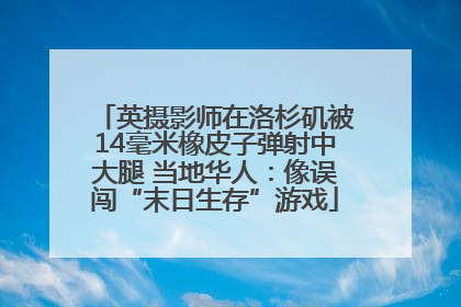 英摄影师在洛杉矶被14毫米橡皮子弹射中大腿 当地华人：像误闯“末日生存”游戏